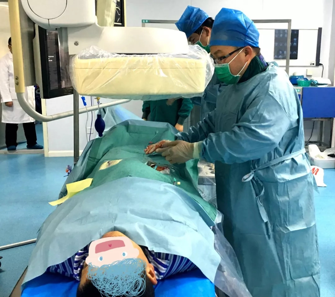 上海歐教授親赴鹽城操刀，介入術治療肝血管瘤，傷口僅有針眼大小